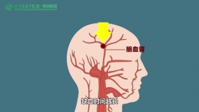 醫院卒中中心動漫